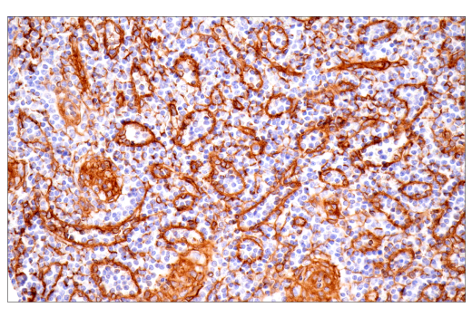 Immunohistochemistry Image 6: Integrin α1/CD49a (E9K2J) XP<sup>®</sup> Rabbit mAb (BSA and Azide Free)