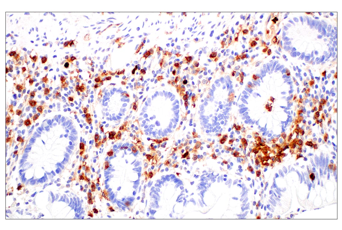 Immunohistochemistry Image 12: CD11b/ITGAM (E3J2F) Rabbit mAb
