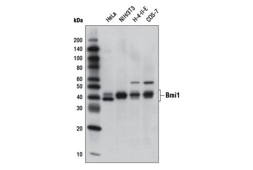 Western Blotting Image 1: Bmi1 (DC9) Mouse mAb