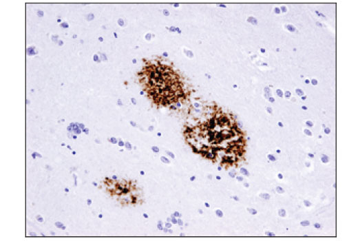 undefined Image 10: β-Amyloid Mouse Model Neuronal Viability IF Antibody Sampler Kit