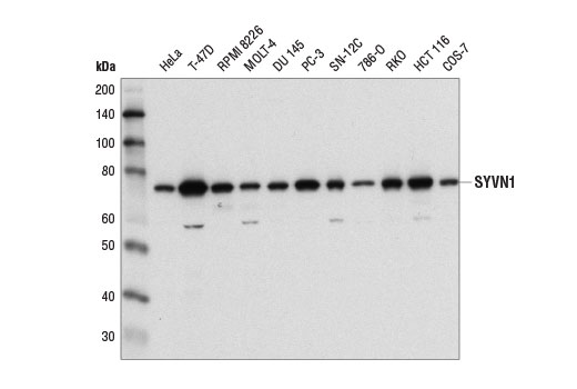 Western Blotting Image 1: SYVN1 (D3O2A) Rabbit mAb