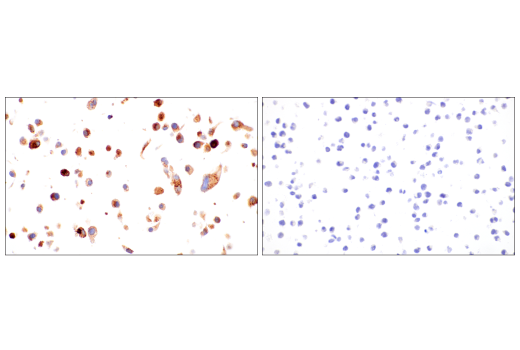 Immunohistochemistry Image 8: TIMP1 (D10E6) Rabbit mAb (BSA and Azide Free)