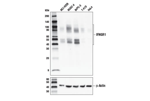 undefined Image 1: MHC Class I Antigen Processing and Presentation Antibody Sampler Kit