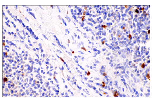 Immunohistochemistry Image 3: Parvalbumin (E8N2U) XP<sup>®</sup> Rabbit mAb