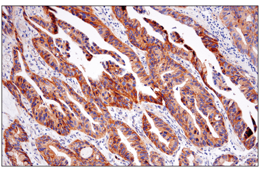 Immunohistochemistry Image 5: CD151 (E4I9J) XP<sup>®</sup> Rabbit mAb