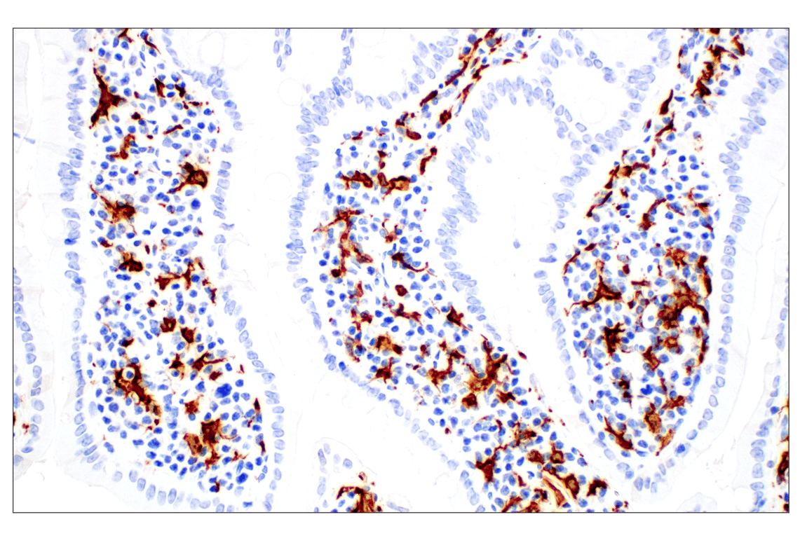 Immunohistochemistry Image 13: Iba1/AIF-1 (E4O4W) XP<sup>®</sup> Rabbit mAb (BSA and Azide Free)