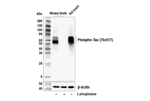 Western Blotting Image 2: Phospho-Tau (Thr217) (E9Y4S) Rabbit mAb (Biotinylated)
