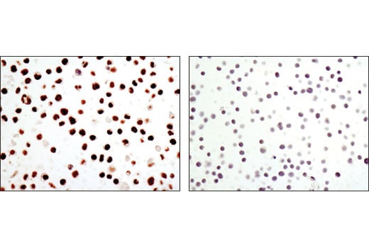 undefined Image 13: C/EBP Antibody Sampler Kit