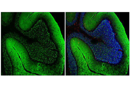 Immunofluorescence Image 2: α-Synuclein (E4U2F) XP<sup>®</sup> Rabbit mAb (BSA and Azide Free)