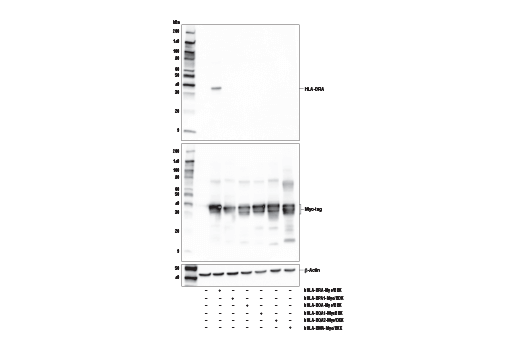 Western Blotting Image 1: HLA-DRA (E9R2Q) XP® Rabbit mAb