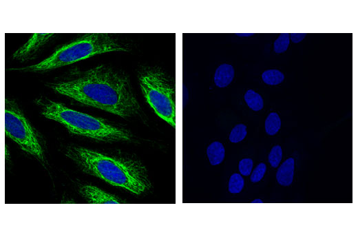 Immunofluorescence Image 1: Keratin 17 (D12E5) XP<sup>®</sup> Rabbit mAb