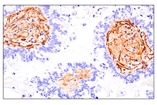 Immunohistochemistry Image 3: CD248 (E9Z7O) XP<sup>®</sup> Rabbit mAb