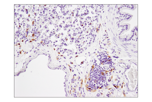 Immunohistochemistry Image 3: CD4 (D7D2Z) Rabbit mAb (BSA and Azide Free)