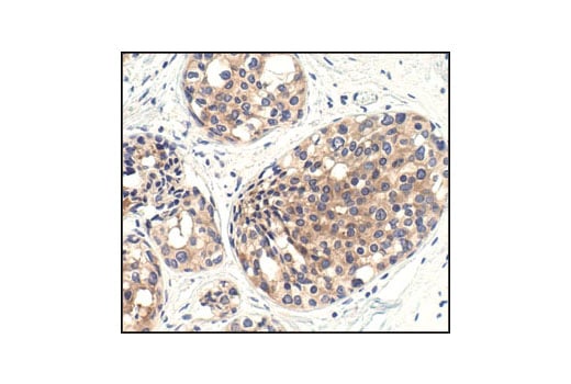 undefined Image 15: TREM2-dependent mTOR Metabolic Fitness Antibody Sampler Kit