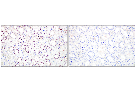 Immunohistochemistry Image 8: POU2F3 (E5N2D) XP<sup>®</sup> Rabbit mAb