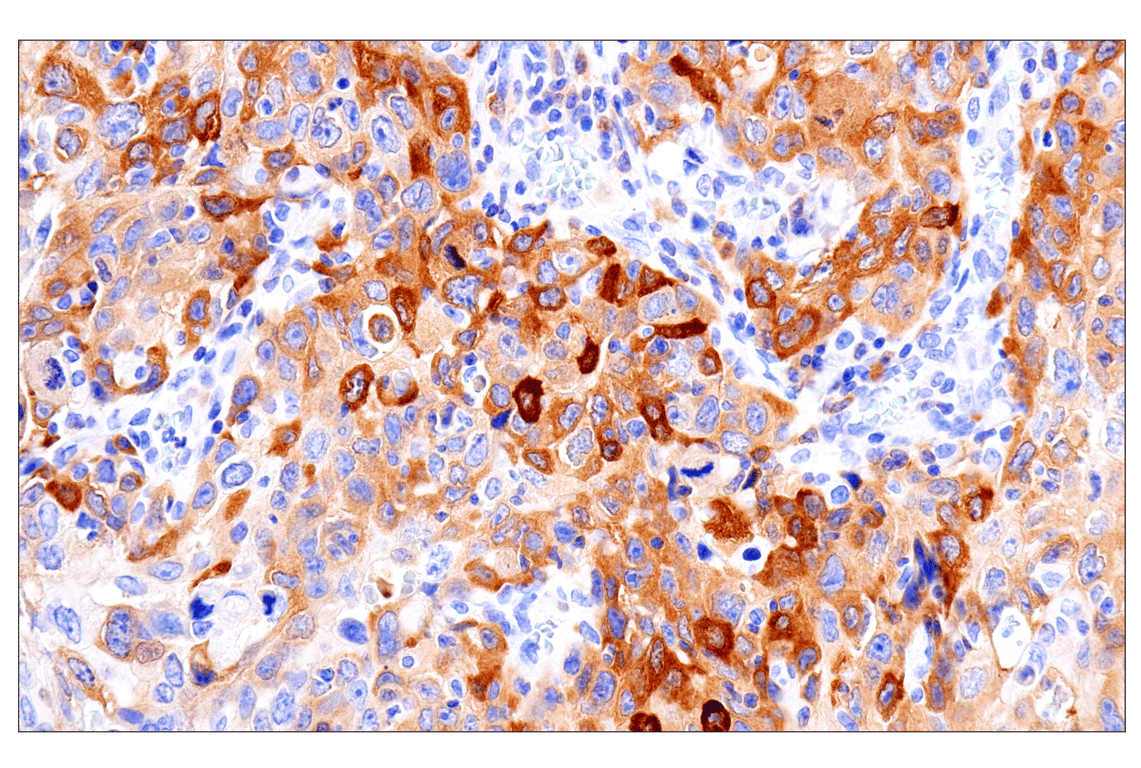 Immunohistochemistry Image 1: Asparagine Synthetase (E6C2C) XP<sup>®</sup> Rabbit mAb (BSA and Azide Free)