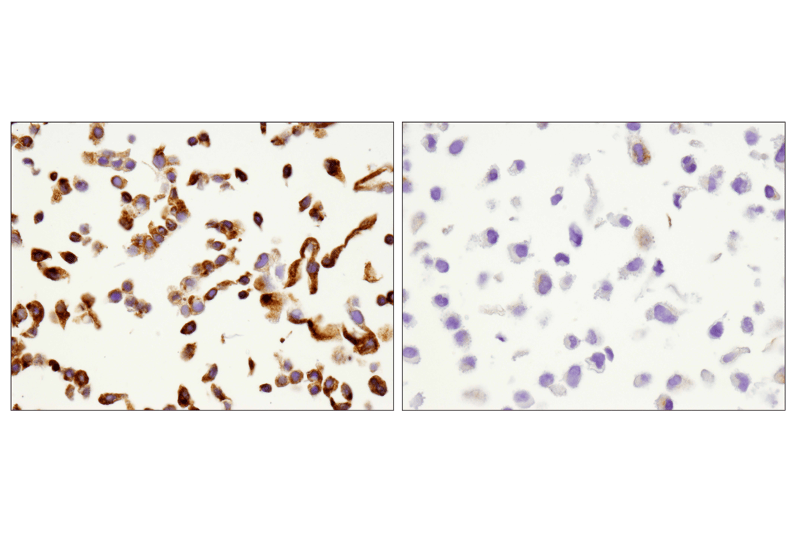 Immunohistochemistry Image 6: VISTA (D1L2G<sup>™</sup>) XP<sup>®</sup> Rabbit mAb
