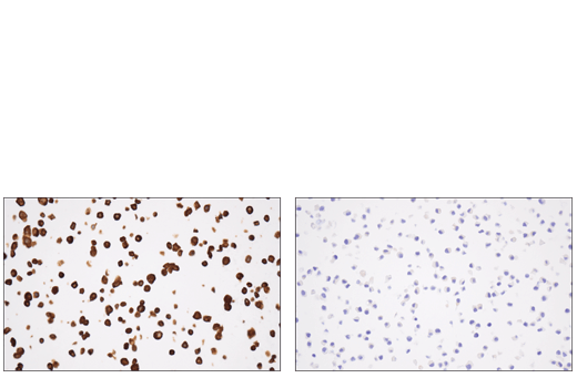 Immunohistochemistry Image 2: Tyrosine Hydroxylase (E2L6M) Rabbit mAb