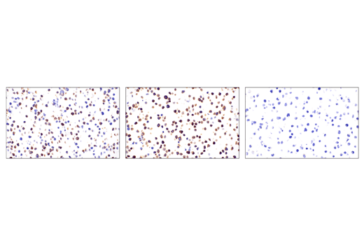 Immunohistochemistry Image 5: Phospho-SLP-76 (Ser376) (E3G9U) XP<sup>®</sup> Rabbit mAb