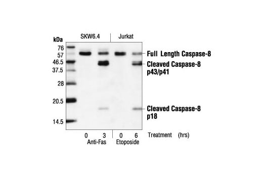 undefined Image 23: Apoptosis Antibody Sampler Kit II