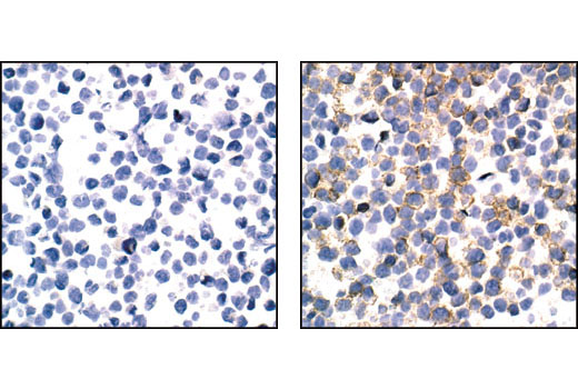 Immunohistochemistry Image 1: Phospho-CSF-1R/M-CSF-R (Tyr723) (49C10) Rabbit mAb (BSA and Azide Free)