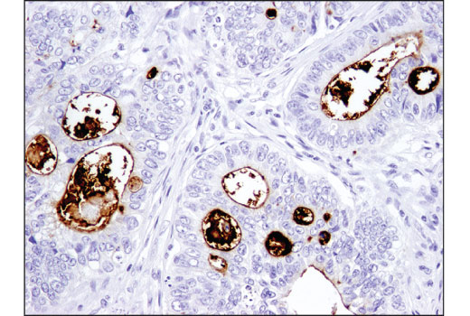 Immunohistochemistry Image 2: CD133 (D4W4N) XP<sup>®</sup> Rabbit mAb (BSA and Azide Free)