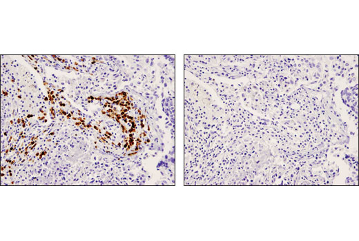 Immunohistochemistry Image 2: CD79A (D1X5C) XP<sup>®</sup> Rabbit mAb (BSA and Azide Free)