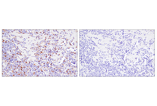 Immunohistochemistry Image 3: 4-1BB/CD137/TNFRSF9 (E6Z7F) XP<sup>®</sup> Rabbit mAb (BSA and Azide Free)