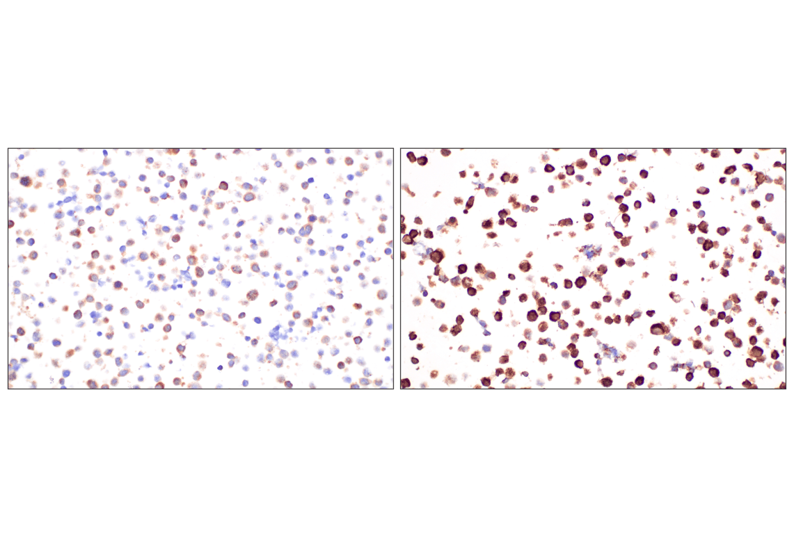 Immunohistochemistry Image 10: Fumarase (D9C5) Rabbit mAb