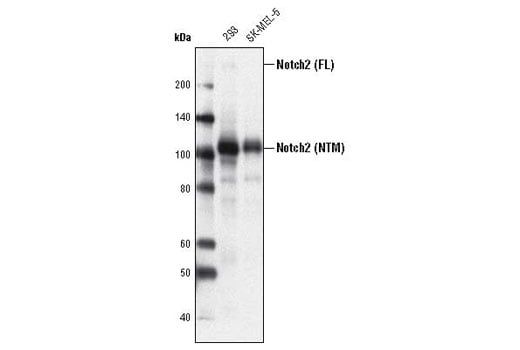 Western Blotting Image 1: Notch2 (D76A6) XP<sup>®</sup> Rabbit mAb (BSA and Azide Free)