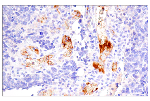 Immunohistochemistry Image 1: Fibrinogen gamma chain (E1U3Z) XP<sup>®</sup> Rabbit mAb