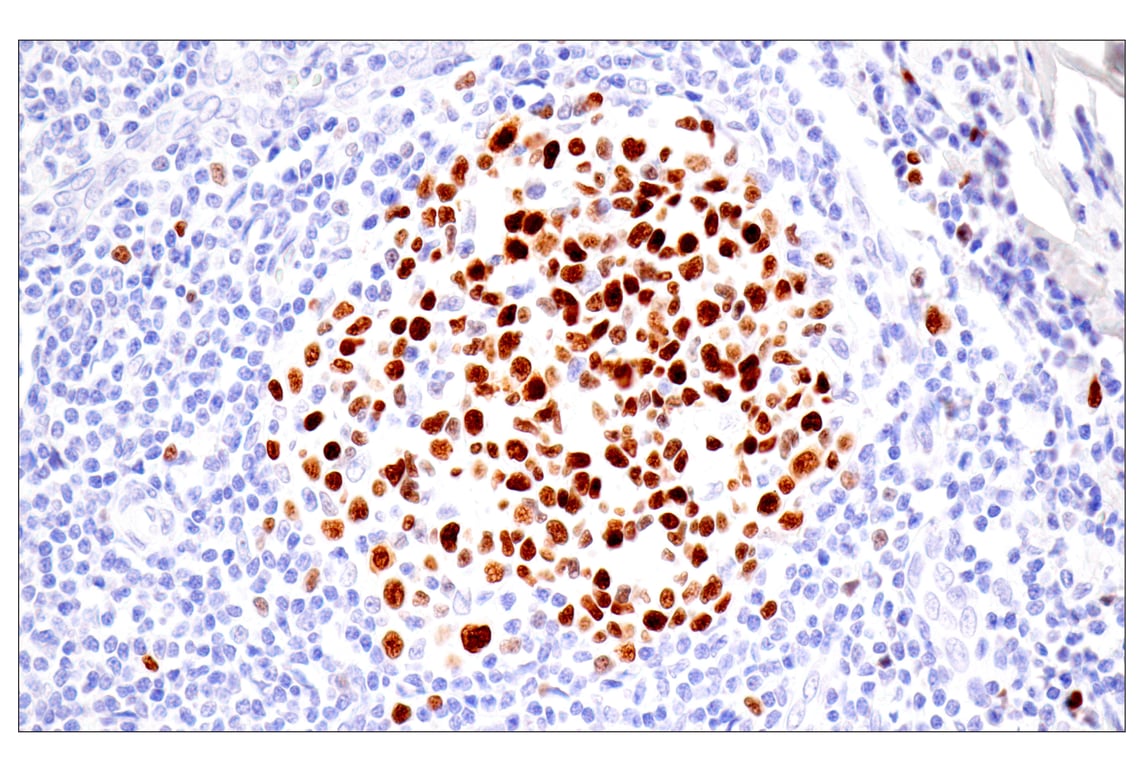 Immunohistochemistry Image 9: UHRF1 (E5W8W) Rabbit mAb