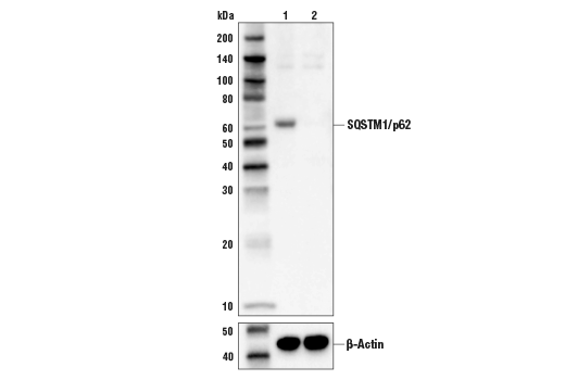 undefined Image 10: Mitophagy Antibody Sampler Kit