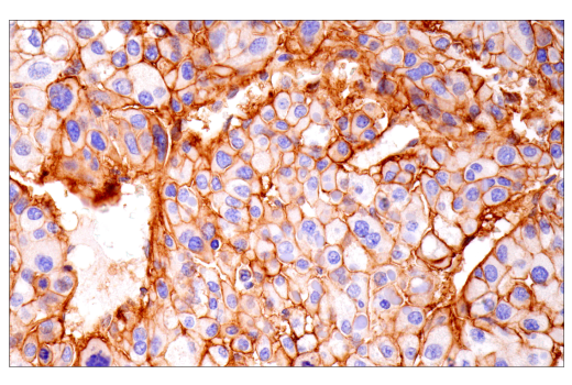 Immunohistochemistry Image 8: Integrin α1/CD49a (E9K2J) XP<sup>®</sup> Rabbit mAb (BSA and Azide Free)