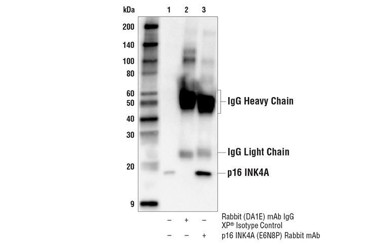 Immunoprecipitation Image 1: p16 INK4A (E6N8P) Rabbit mAb