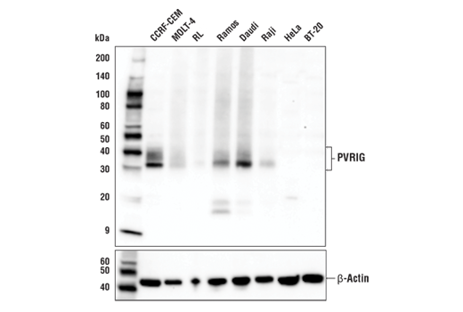 Western Blotting Image 1: PVRIG (E9X9B) Rabbit mAb