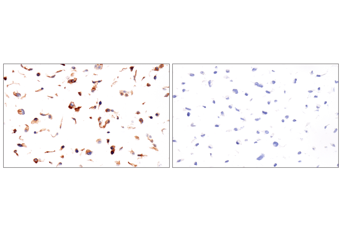 Immunohistochemistry Image 7: Folate Receptor Alpha/FOLR1 (BN3.2) Mouse mAb