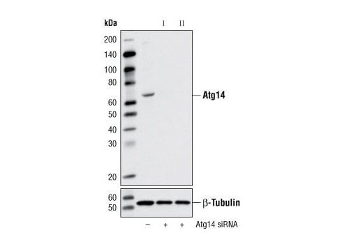 undefined Image 1: SignalSilence<sup>®</sup> Atg14 siRNA I
