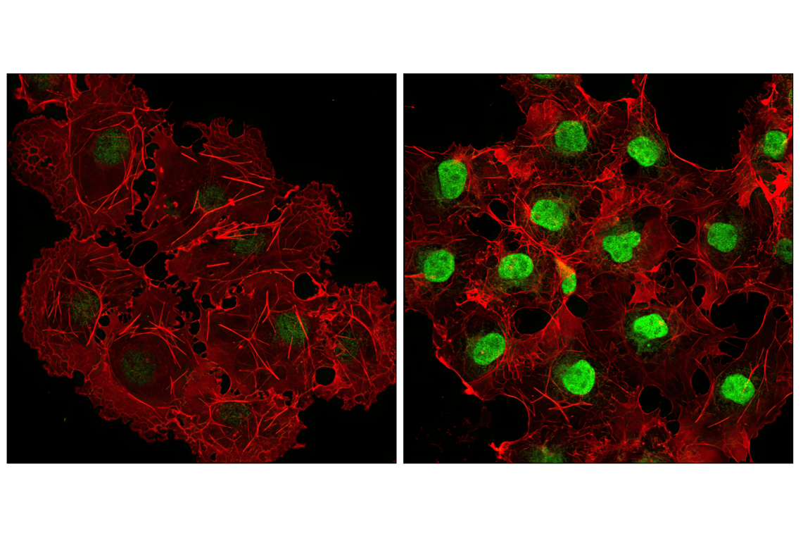 undefined Image 39: Angiogenesis Antibody Sampler Kit