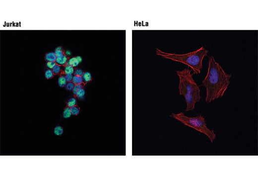 Immunofluorescence Image 1: Bcl-11B (D6F1) XP<sup>®</sup> Rabbit mAb (BSA and Azide Free)