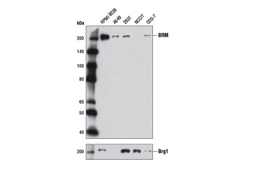 undefined Image 15: BAF Complex IHC Antibody Sampler Kit