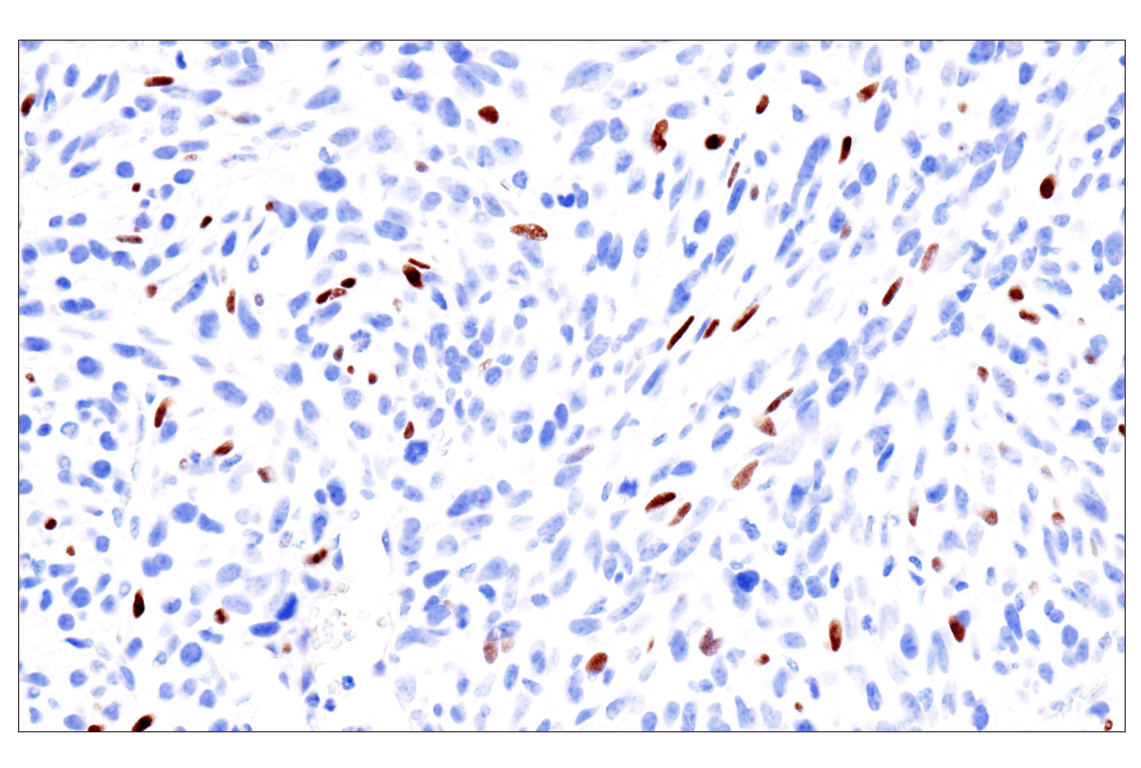 Immunohistochemistry Image 17: GATA-6 (D61E4) XP<sup>®</sup> Rabbit mAb (BSA and Azide Free)