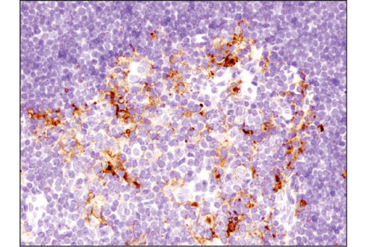 Immunohistochemistry Image 5: PD-L1 (D5V3B) Rabbit mAb