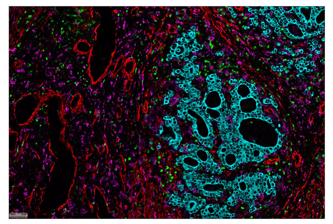 Immunohistochemistry Image 7: CD163 (D6U1J) & CO-0022-647 SignalStar<sup>™</sup> Oligo-Antibody Pair