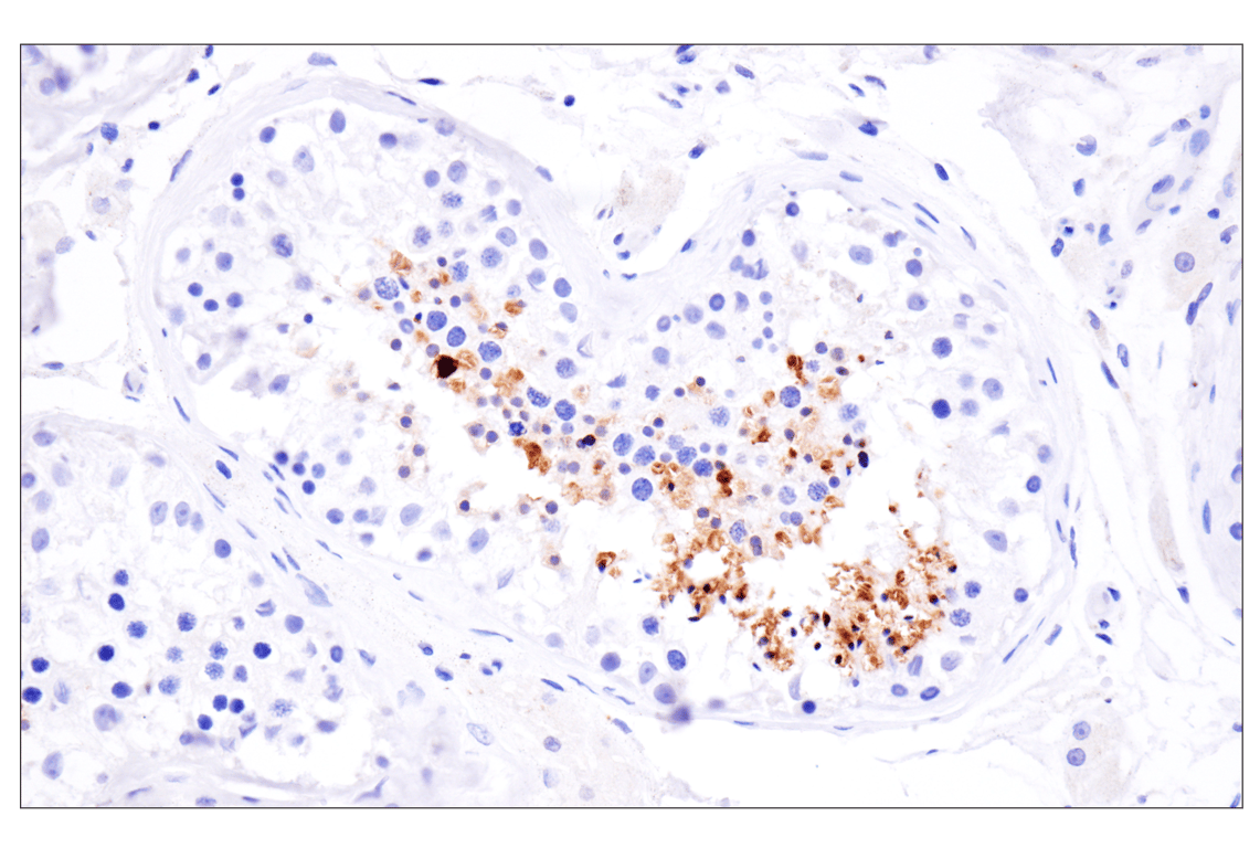 Immunohistochemistry Image 3: KK-LC-1 (F3U6C) Rabbit mAb