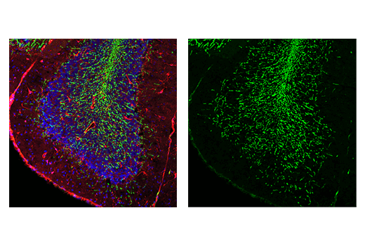 undefined Image 19: Demyelinating Disease Targets Antibody Sampler Kit