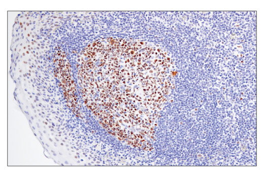 Immunohistochemistry Image 2: BCL6 (E5I8I) Rabbit mAb