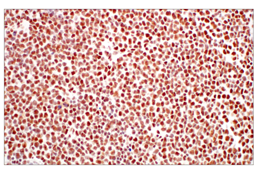 Immunohistochemistry Image 4: METTL3 (E3F2A) Rabbit mAb (BSA and Azide Free)