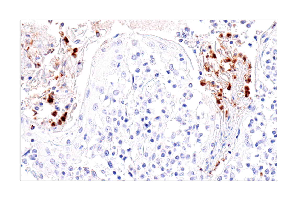 Immunohistochemistry Image 2: IL-8 (E5F5Q) XP<sup>®</sup> Rabbit mAb (BSA and Azide Free)