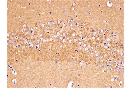 Immunohistochemistry Image 1: Huntingtin (D7F7) XP<sup>®</sup> Rabbit mAb